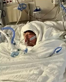 Mason Dark recovering in Burn Unit photo by GoFundMe